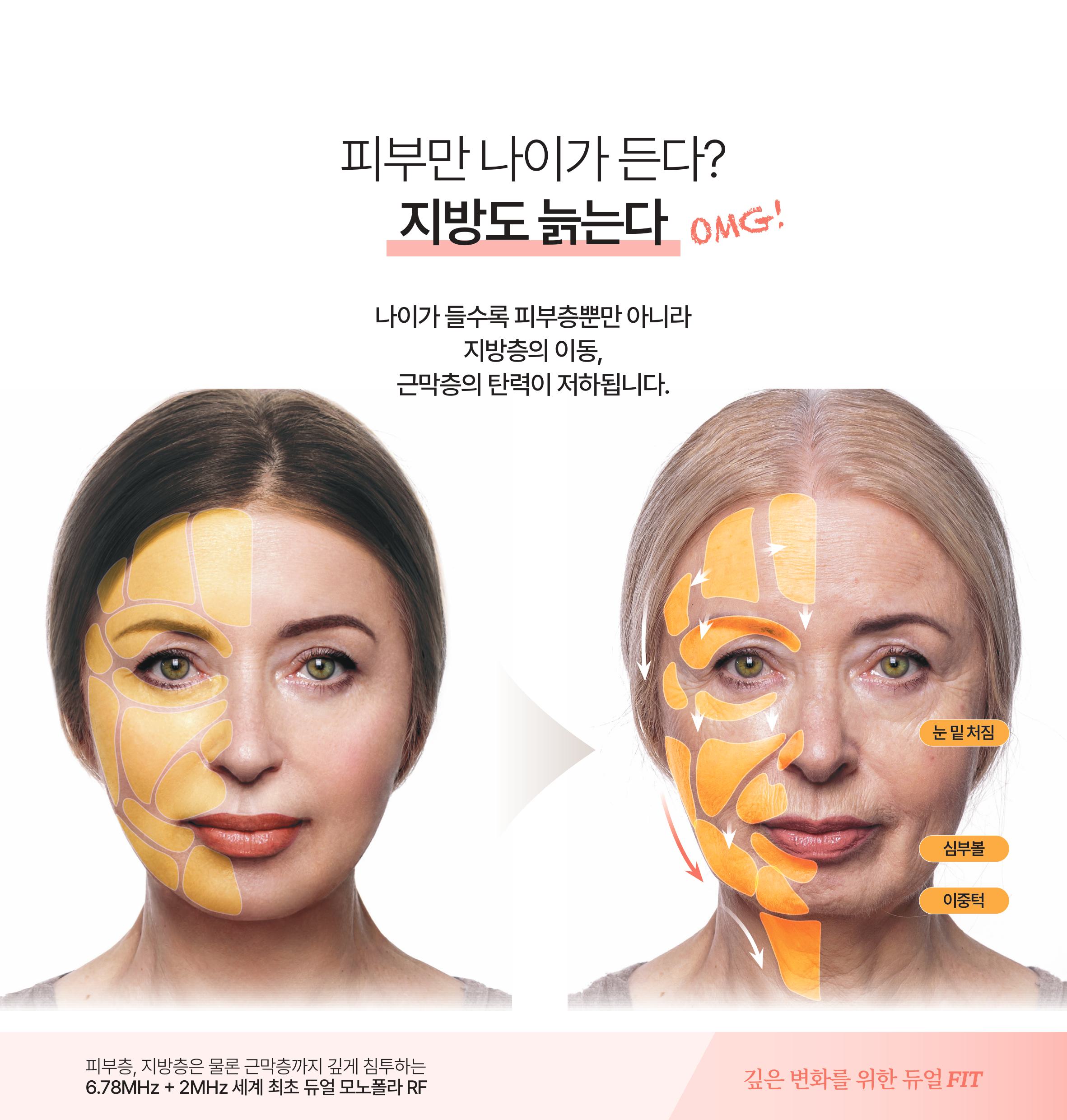 랜딩이미지