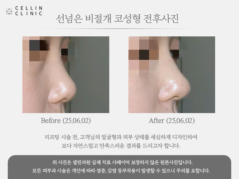 랜딩이미지