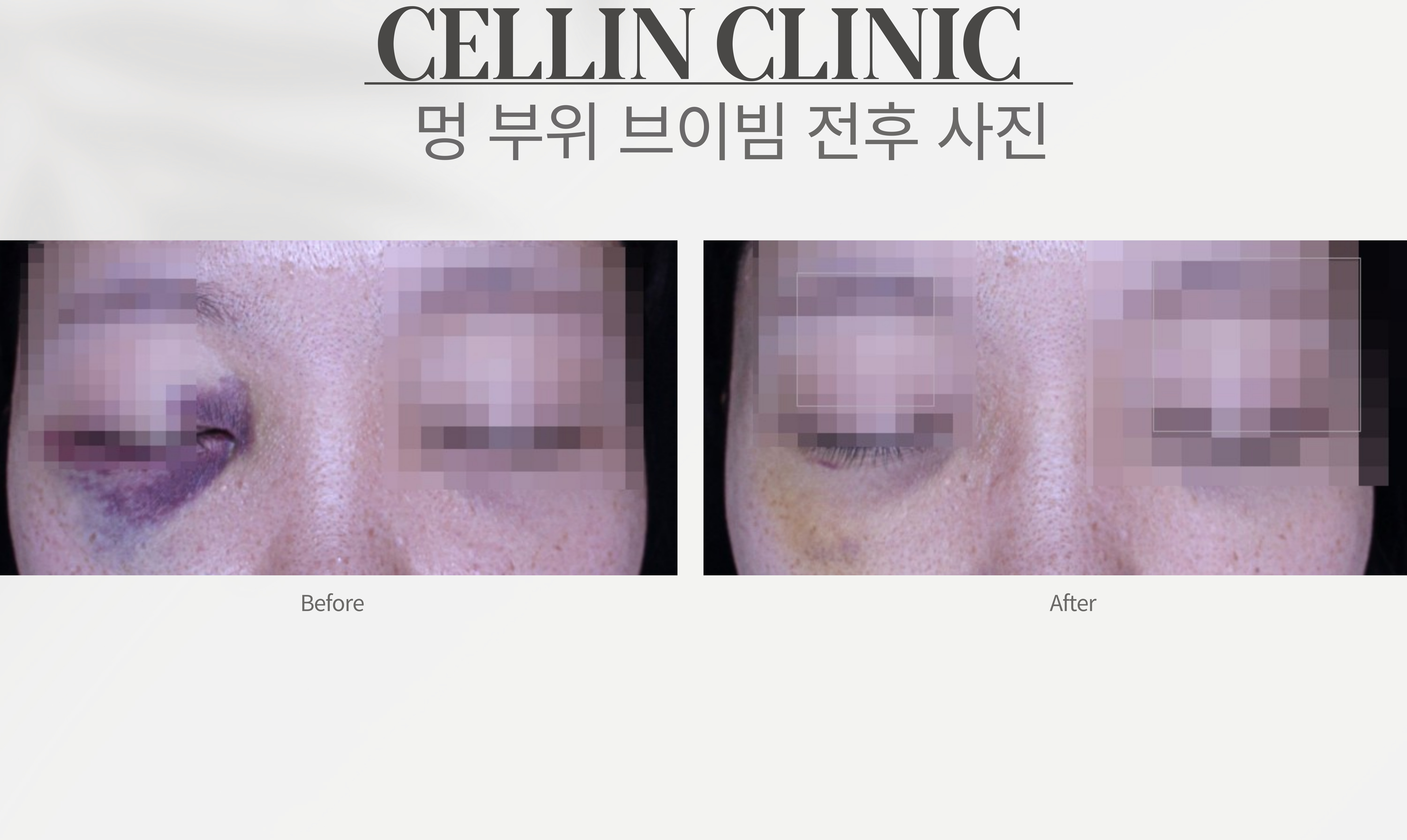랜딩이미지