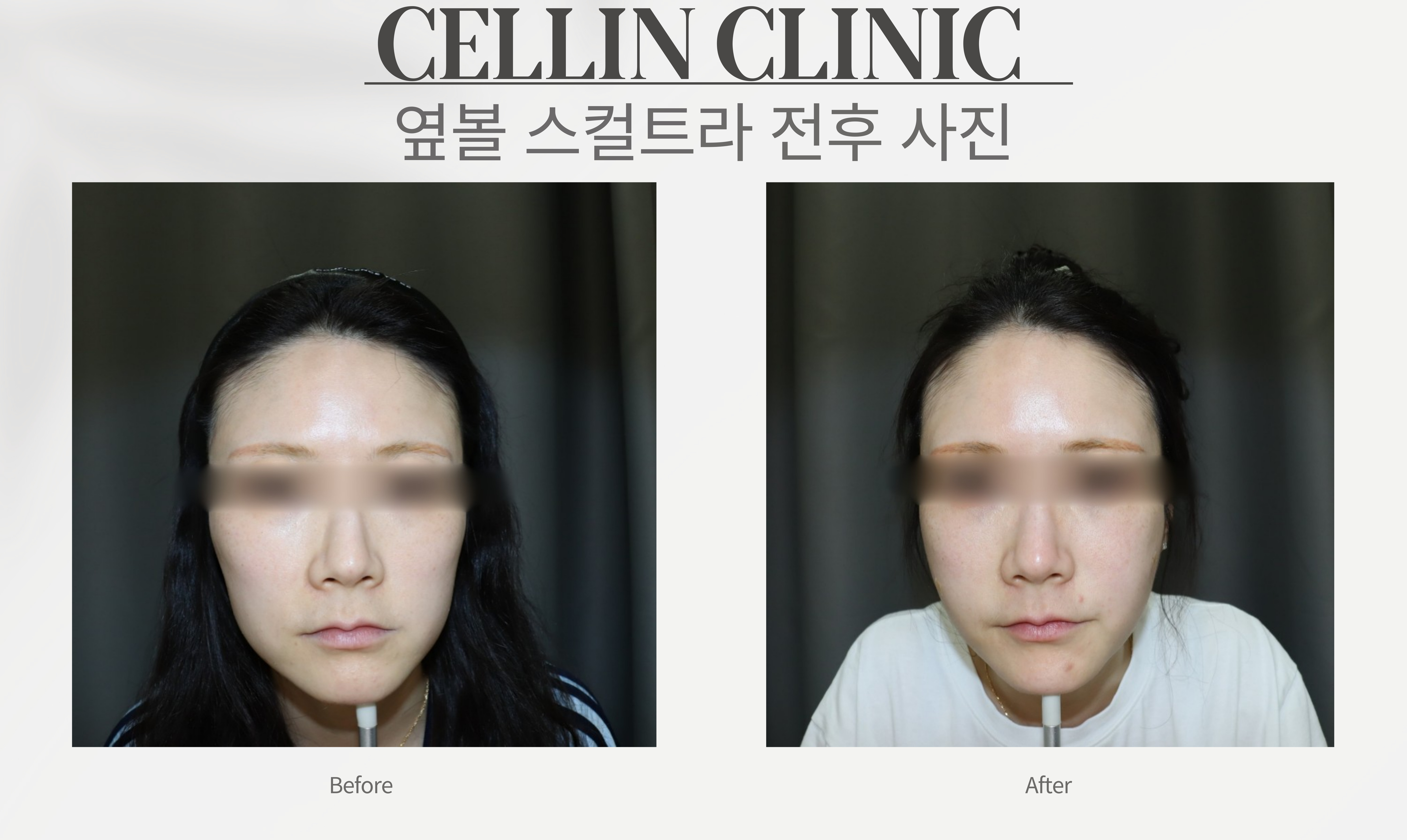 랜딩이미지