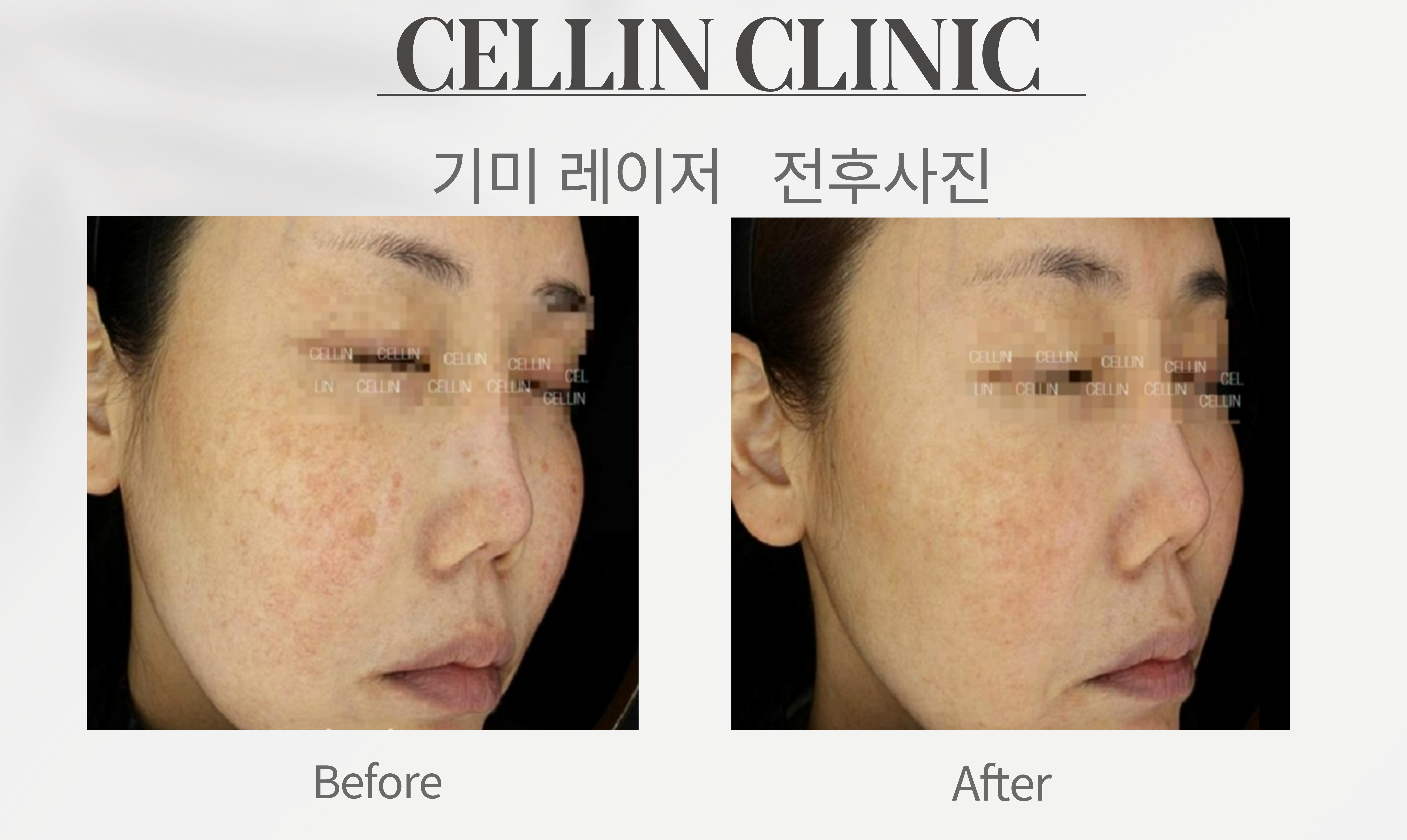 랜딩이미지