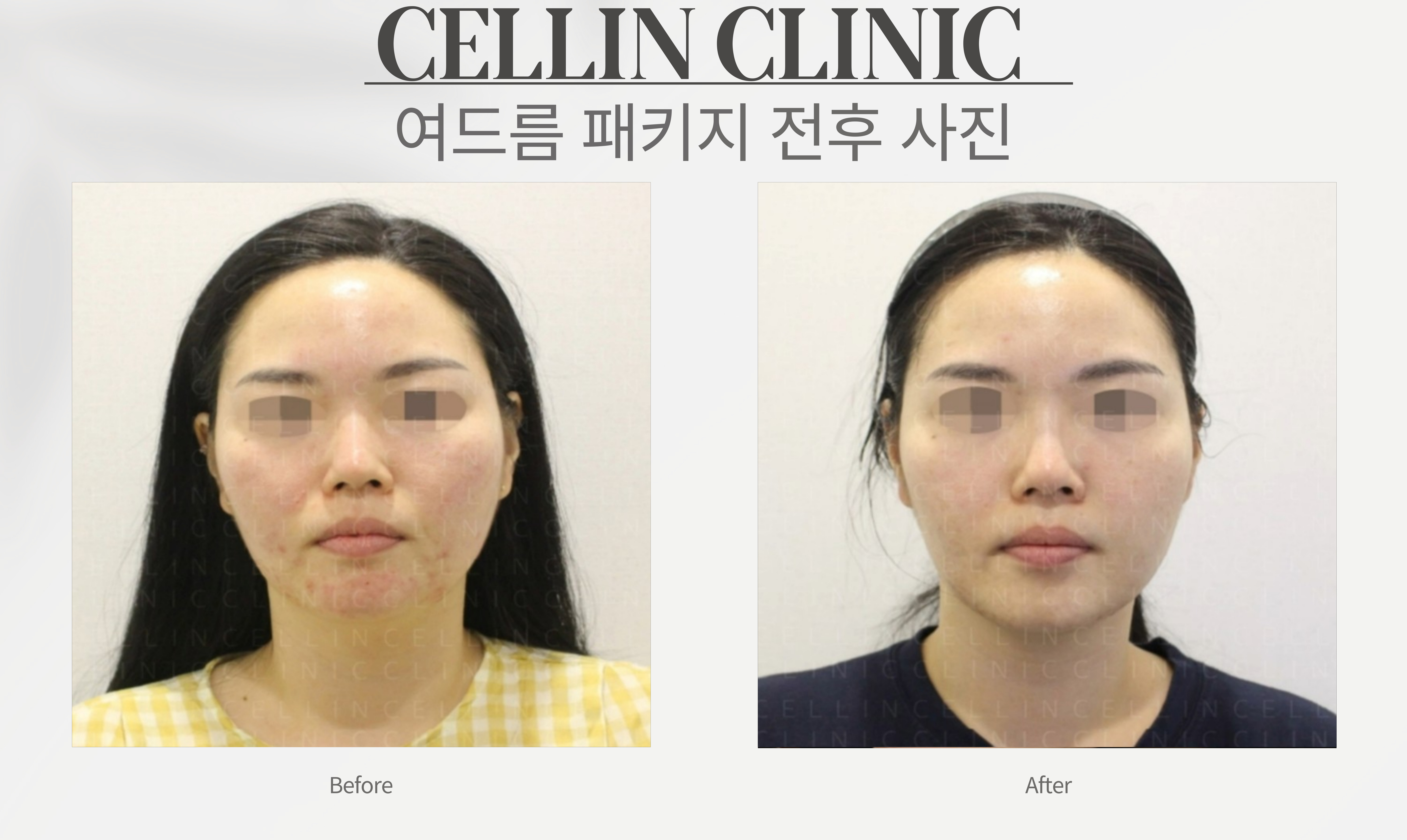 랜딩이미지