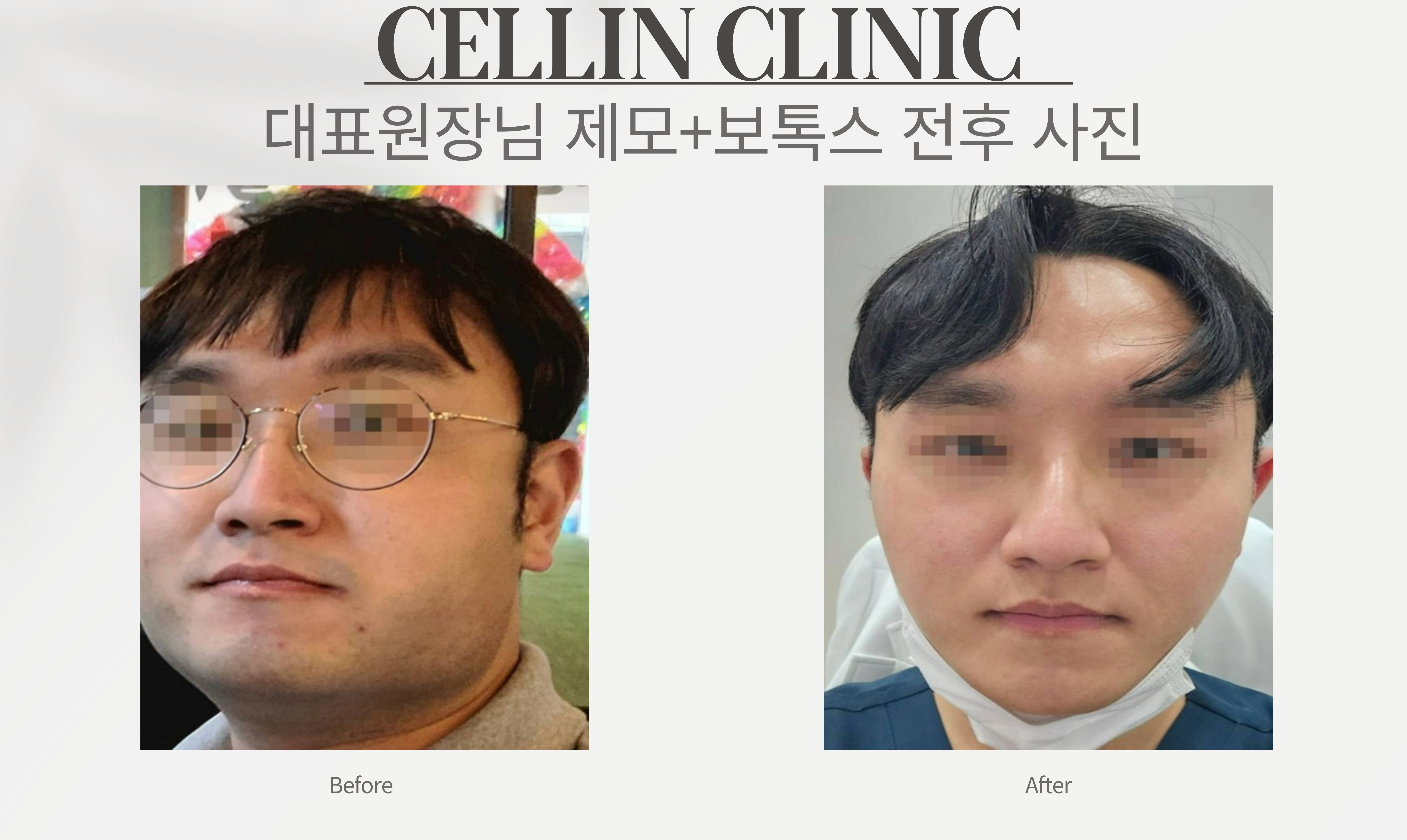 랜딩이미지