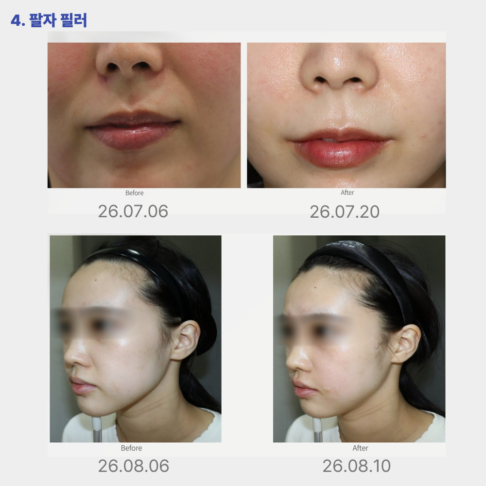 랜딩이미지