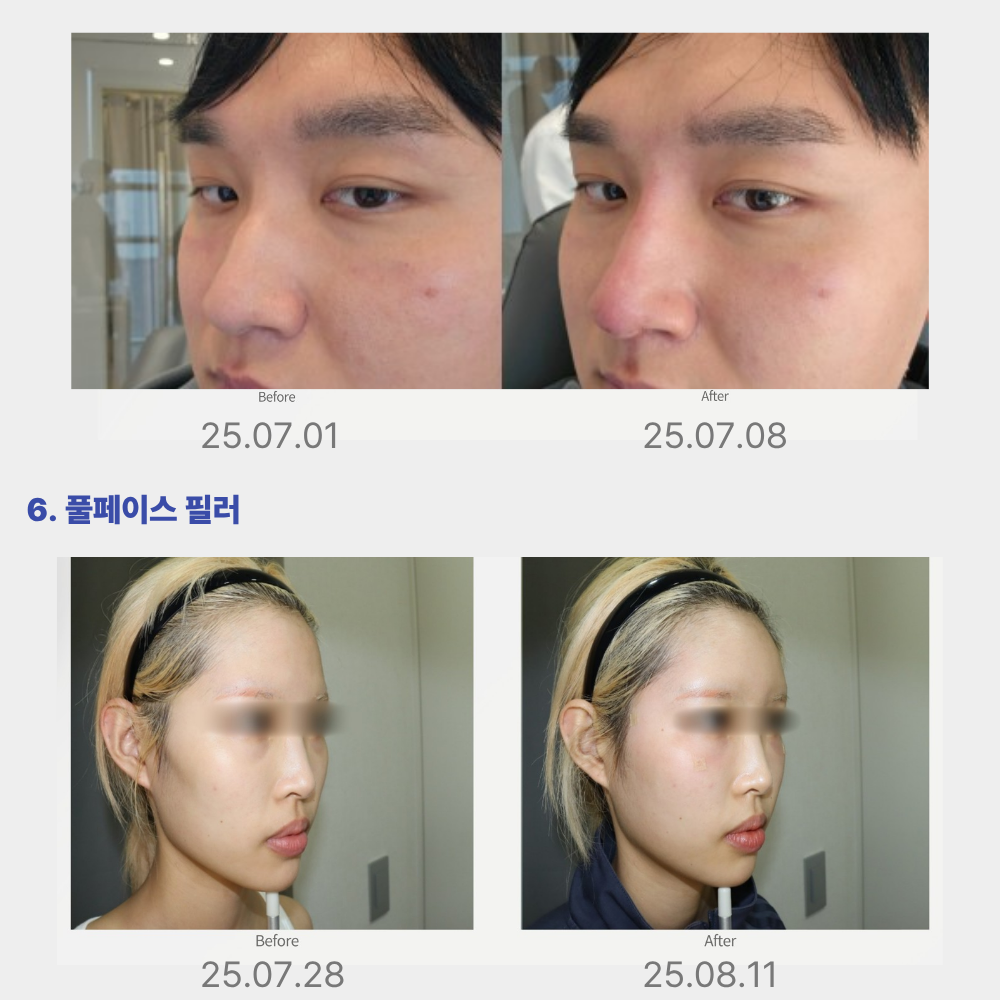 랜딩이미지